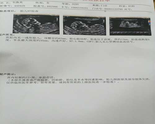 武汉哪里有代孕公司,武汉41岁三代试管成功率，武汉试管婴儿费用