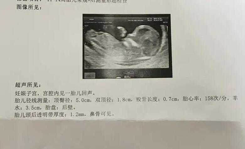武汉供卵的等几年 武汉第三代试管婴儿医院费用组成? ‘怀孕34周女孩的特征’