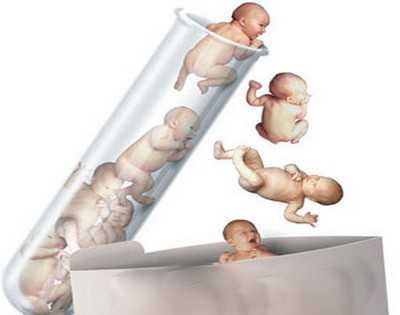 代孕产子的医院_2021我想代孕_做试管婴儿哪里做的好 想做试管婴儿却发现少精