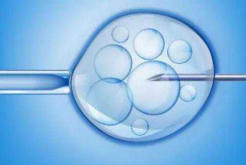 国内那里有靠谱代孕_代孕_想要知道，试管婴儿移植是什么流程啊？